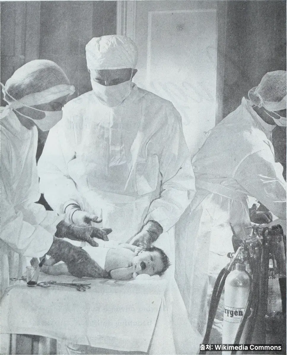 아기 땀띠 없애기 관련 이미지