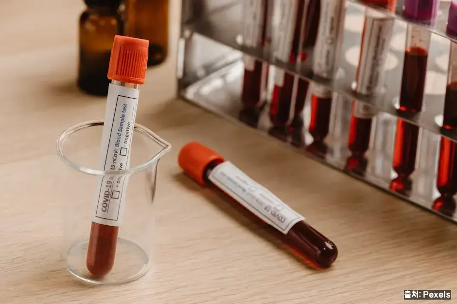 LDL·HDL·중성지방 검사 기준 관련 이미지